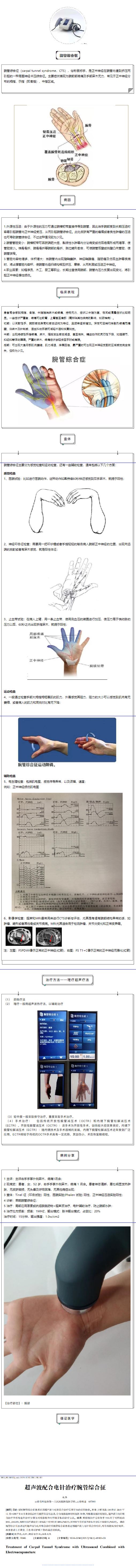 【勤研院】超聲病例分享—腕管綜合征.jpg